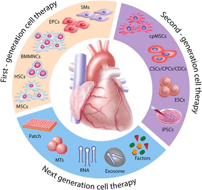 After years of failure, study finds heart was 'pumping stronger' after stem cell therapy